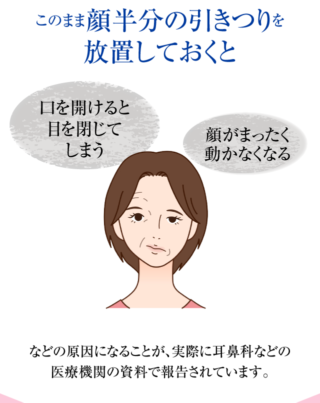 放置しておくと顔が全く動かなくなる